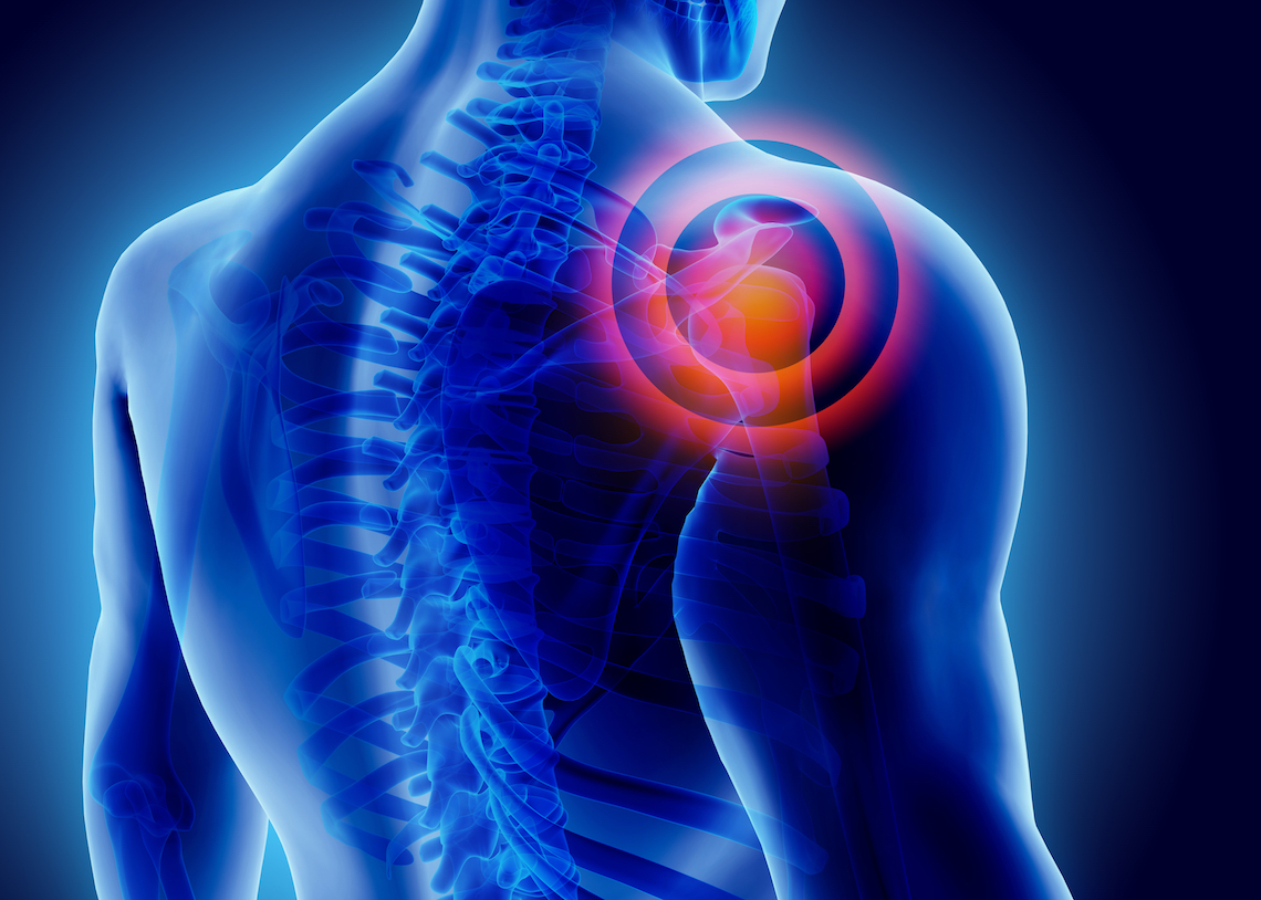 Shoulder-Pain-1