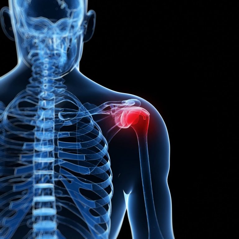 Shoulder injuries featured image