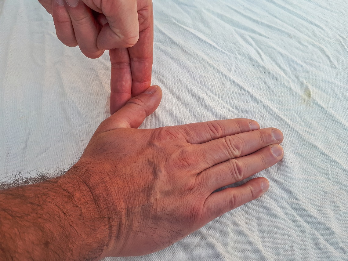 Thumb-osteroarthitis (2)