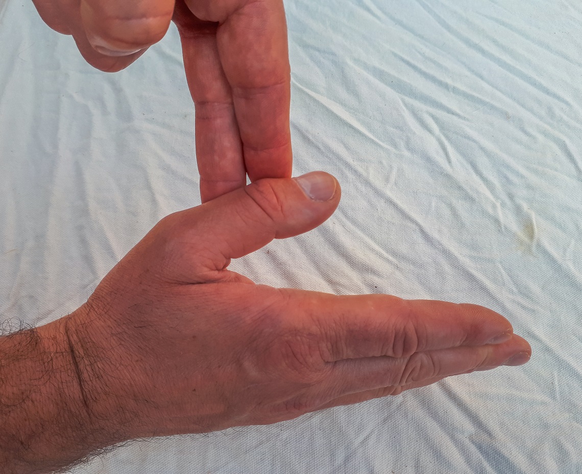 Thumb-osteroarthitis (3)